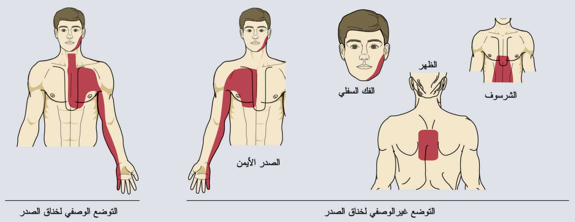 الم بين الثديين - اوجاع مختلفه بين الثديين و اسبابها 705 4