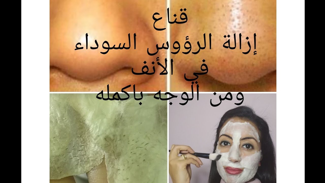 ماسك طبيعي لازالة الرؤوس السوداء 5709 2