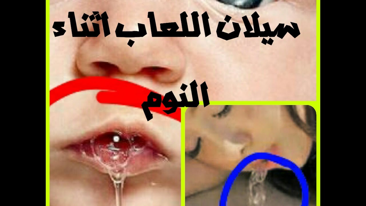 تخلصي من سيلان الفم واللعاب عند طفلك ،علاج سيلان اللعاب عند الاطفال بالاعشاب 5379 1