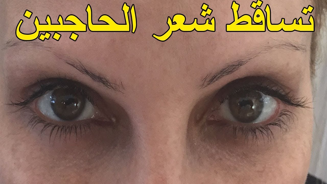 تساقط شعر الحواجب , ما هى اسباب تساقط شعر الحواجب