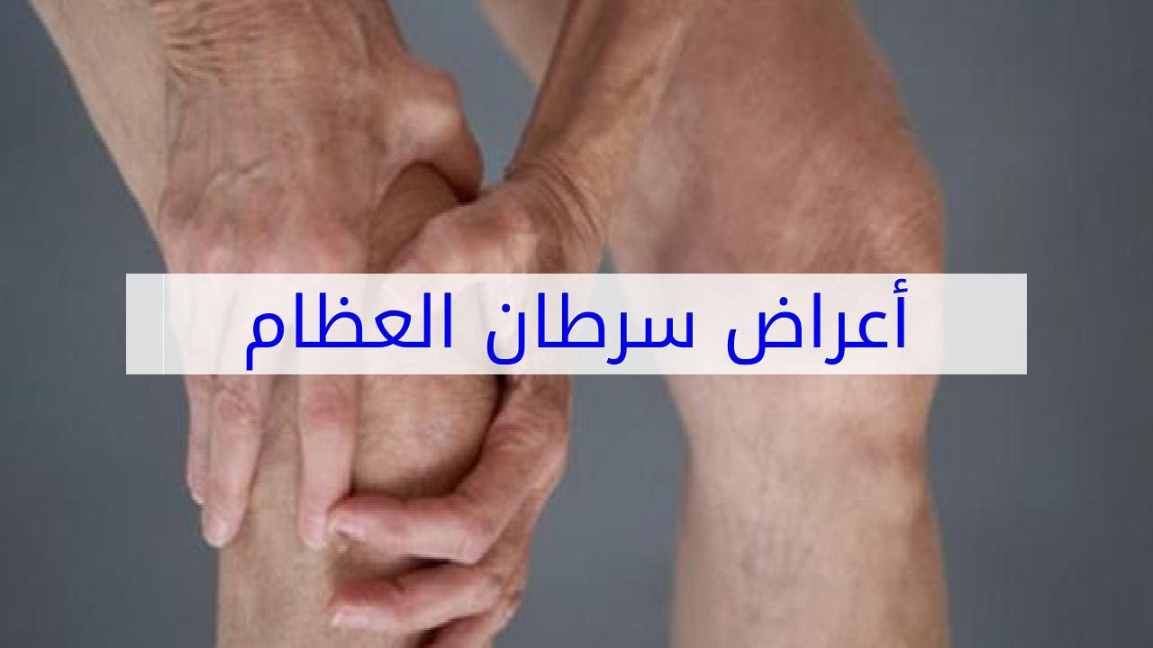 ما هي العلامات التي توضح الاصابه بسرطان العظام , ما اعراض سرطان العظام