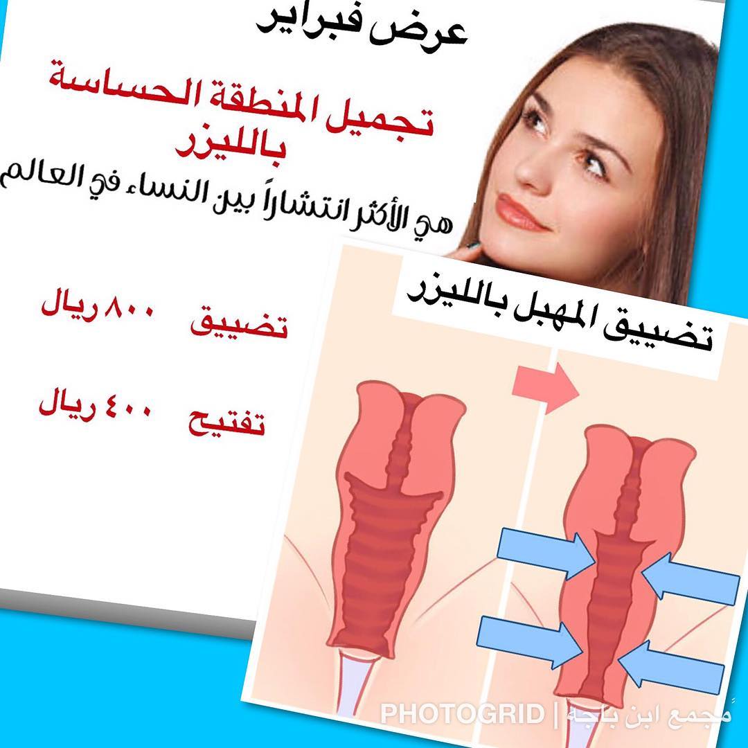 عملية تضييق المهبل بالليزر بالكويت - معلومات عن تضييق المهبل بالليزر في الكويت 531 1