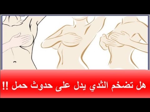 الم الثدي من اعراض الحمل - اعراض الم الثدي اثناء الحمل 947