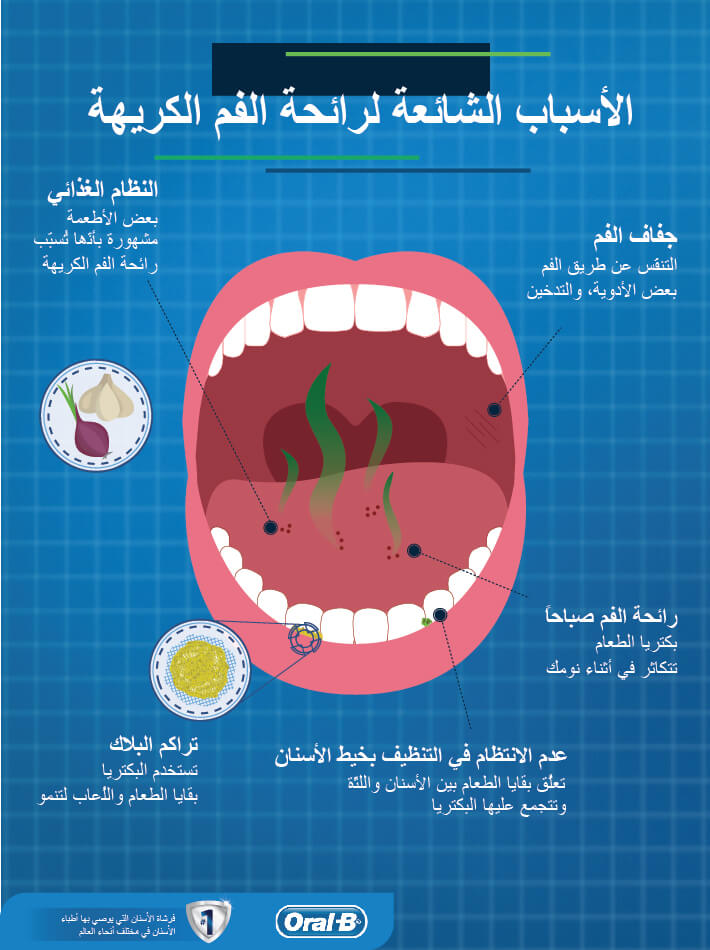 علاج رائحة النفس الكريهة - كيفية التخلص من رائحة النفس الكريهة 1135