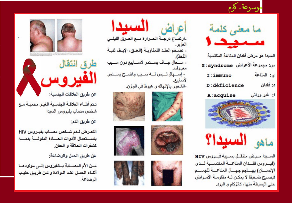 مرض السيدا اسبابه واعراضه وعلاجه - مرض الايدز من اكثر الامراض التى تدمر الانسان 2941