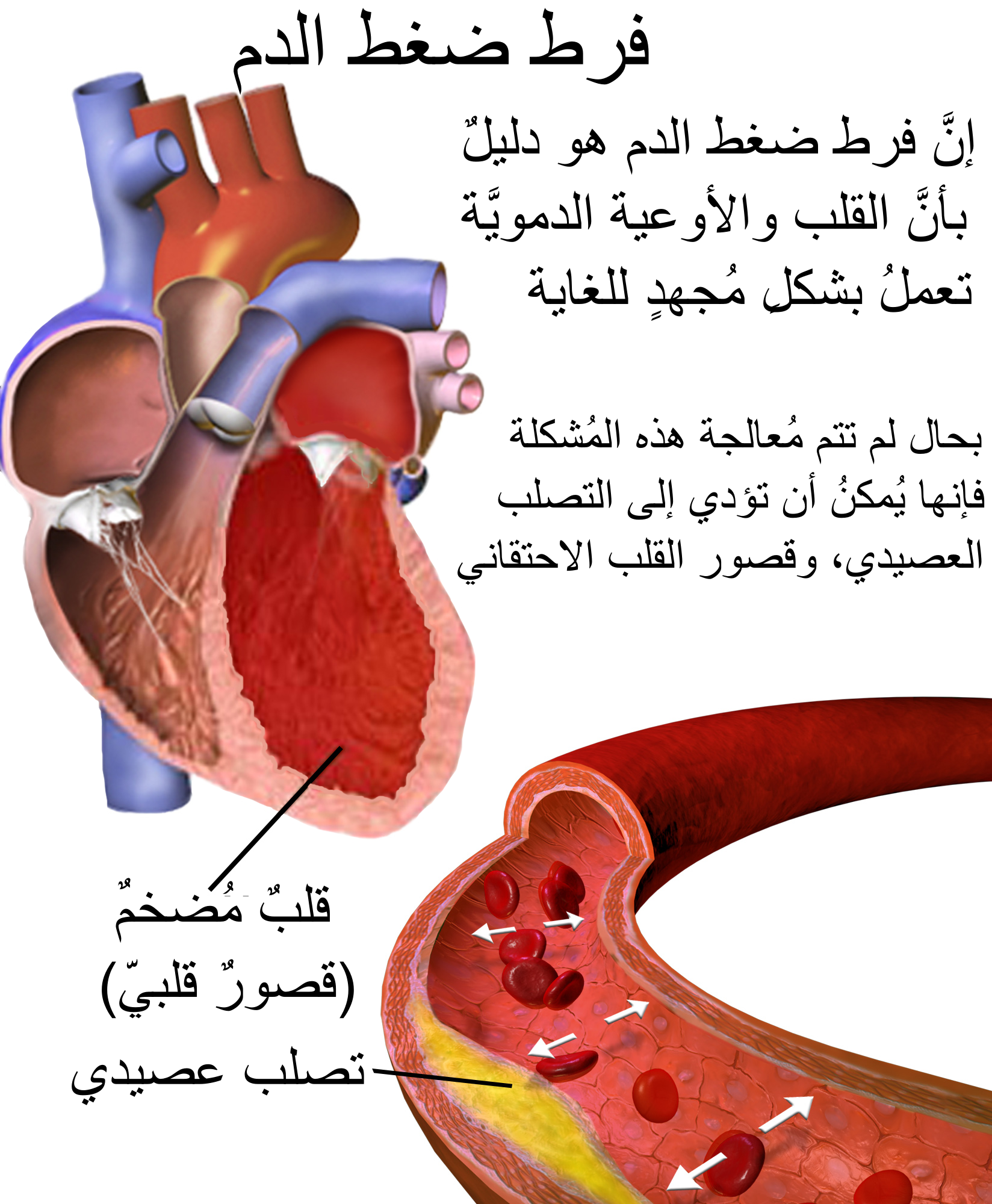 موضوع عن الضغط - ما هو مفهوم الضغط 1340