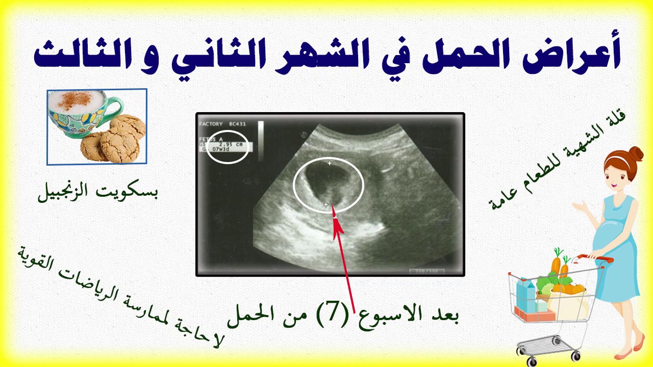 بداية الحمل واعراضه- اهم اعراض الحمل 4163 3