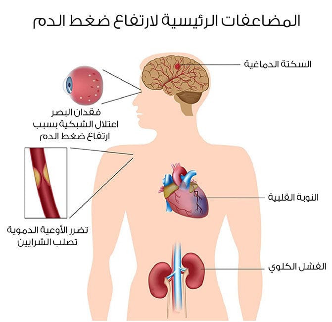 موضوع عن الضغط - ما هو مفهوم الضغط 1340