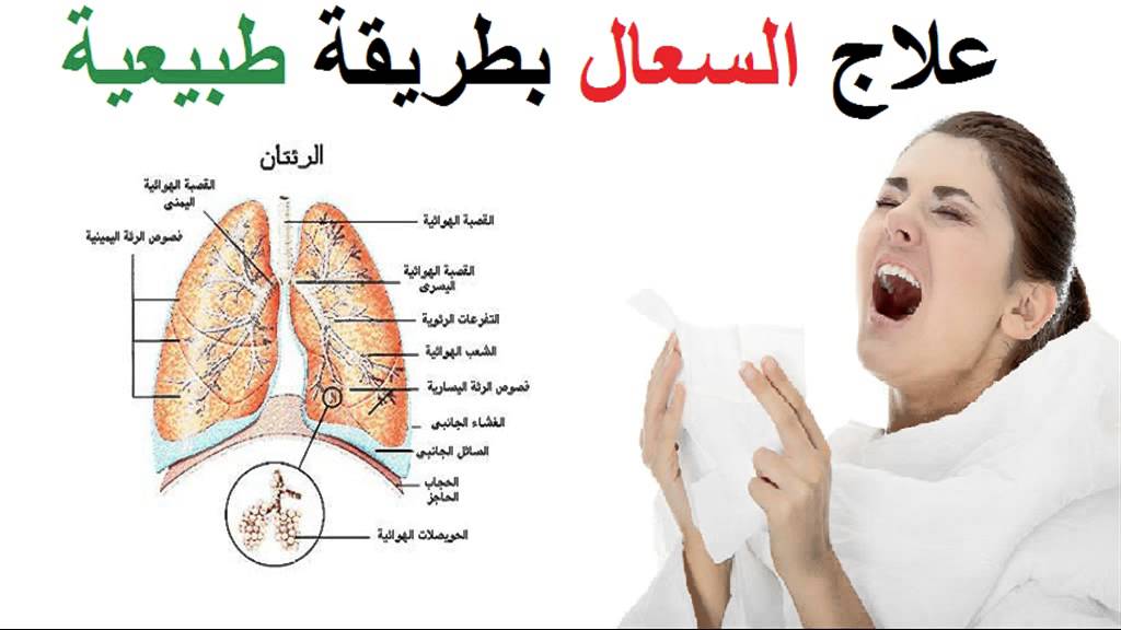 علاج السعال الشديد , هذا العلاج يخلصك من الكحة الشديدة