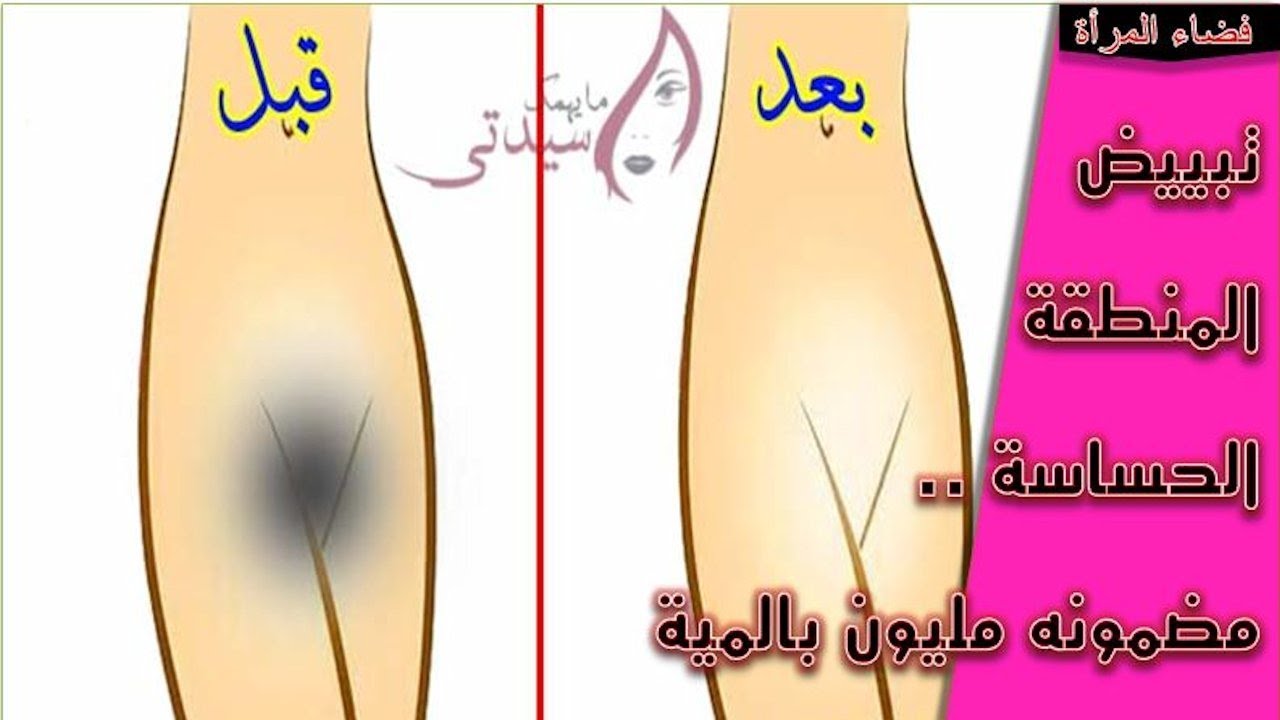 تبييض المناطق الحساسة بسرعة , وصفات مجربة لتفتيج المناطق الغامقة في الجسم